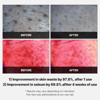 Red Succinic Acid Pads